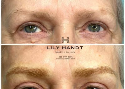 eyebrow microblading