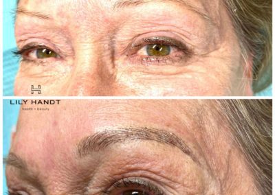 eyebrow microblading