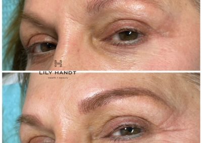 eyebrow microblading before and after