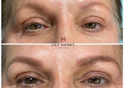 eyebrow microblading before and after