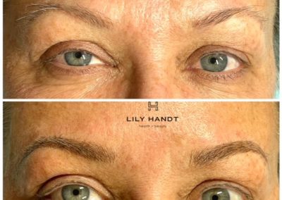 eyebrow microblading before and after