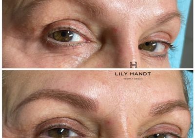 eyebrow microblading before and after