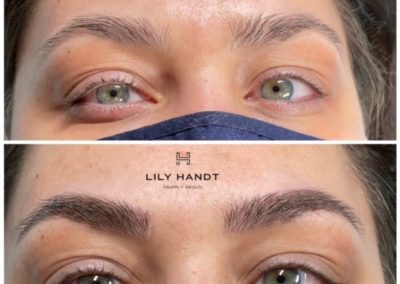 eyebrow microblading before and after