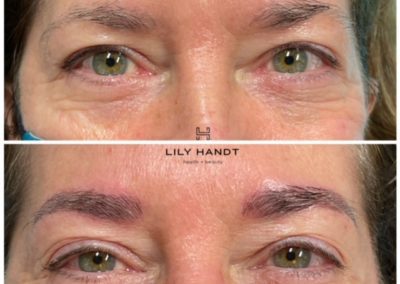 eyebrow microblading before and after