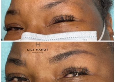 eyebrow microblading before and after
