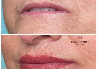 lip shading before and after