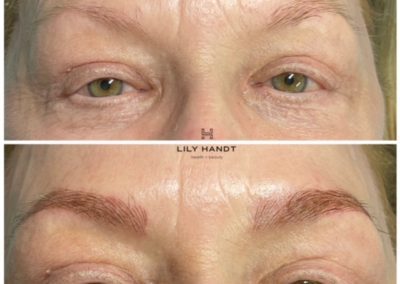 eyebrow microblading before and after