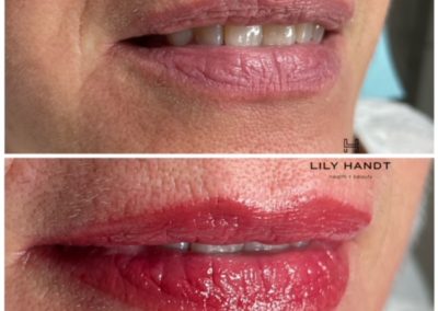 lip shading before and after