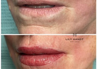 lip shading before and after