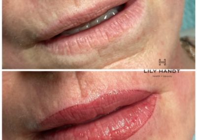 lip shading before and after