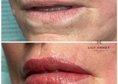 lip shading before and after