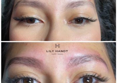 eyebrow microblading before and after