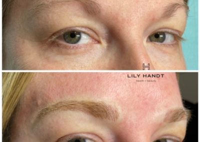 eyebrow microblading before and after