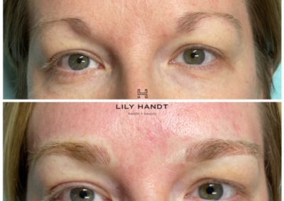 eyebrow microblading before and after