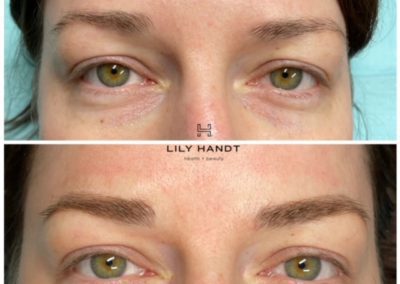 eyebrow microblading before and after