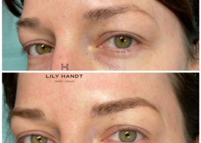 eyebrow microblading before and after