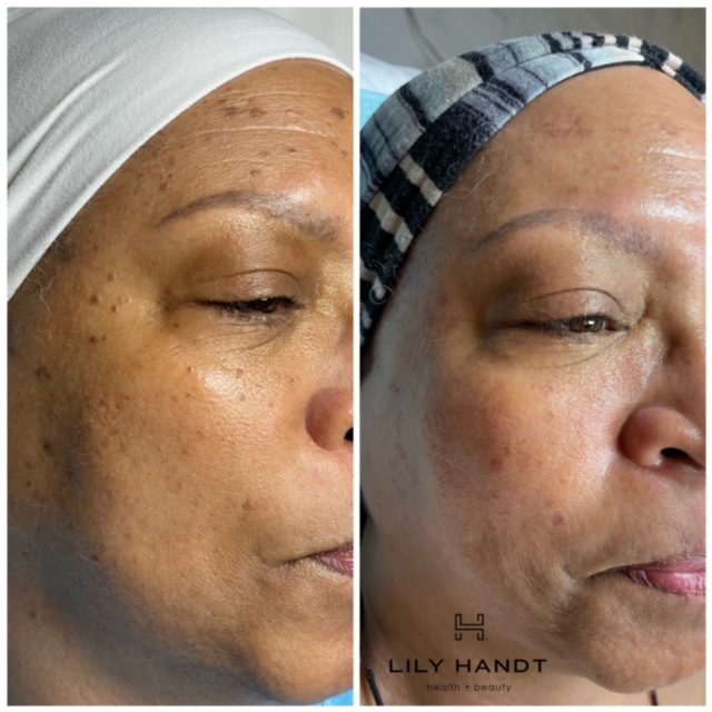 Permanent and Semi-Permanent Makeup